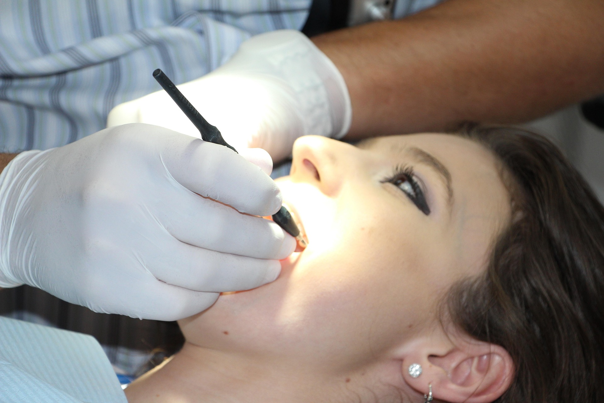 Dépose d’un amalgame dentaire par un dentiste équipé, soins dentaires professionnels chez Urbadental