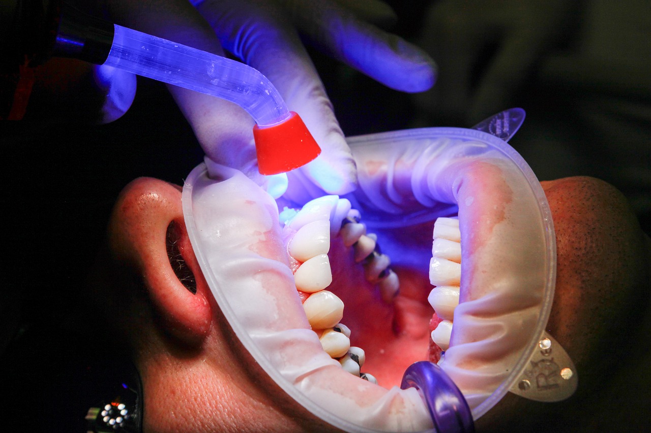 Soins dentaires au laser diode en cabinet – traitement de précision chez Urbadental